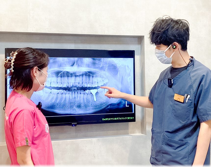 ALBA歯科＆矯正歯科ミウィ橋本院の削る量が少ない治療