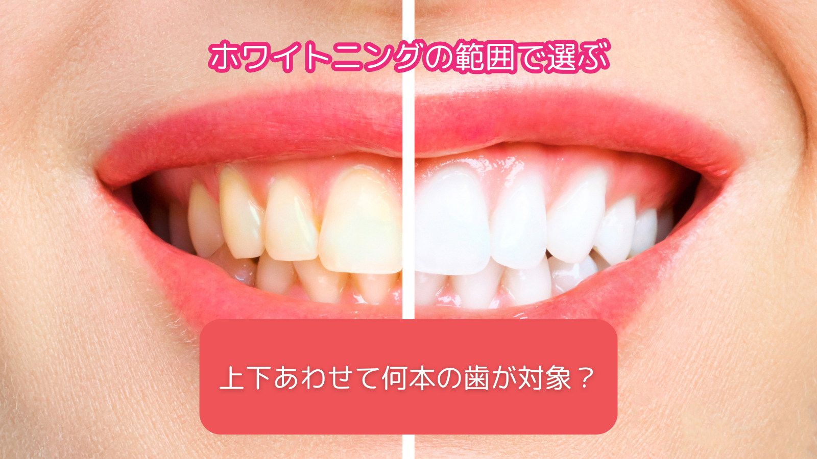 ポイント1