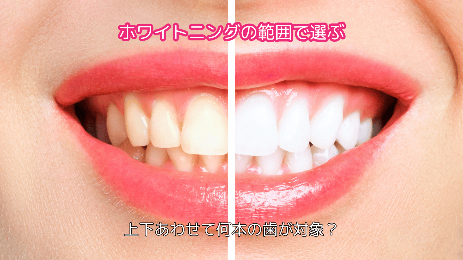 ポイント1