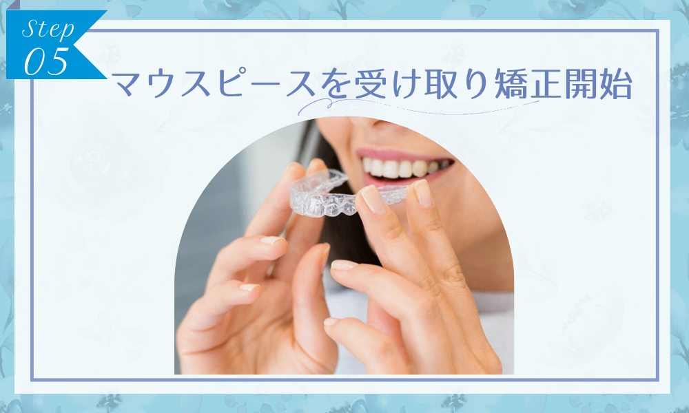 スマイルモア矯正のステップ5