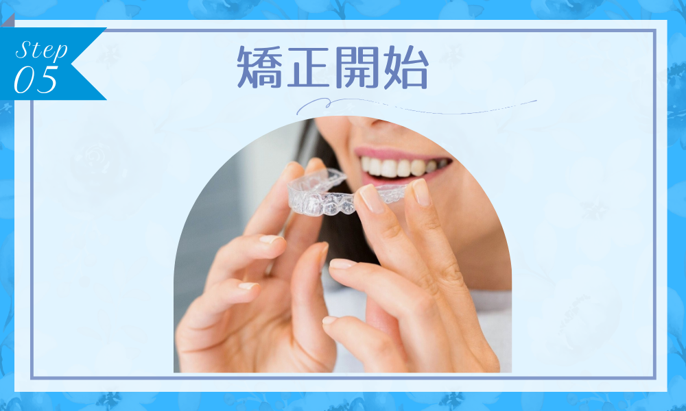 ステップ5