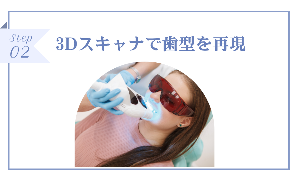 3Dスキャナで歯形を再現