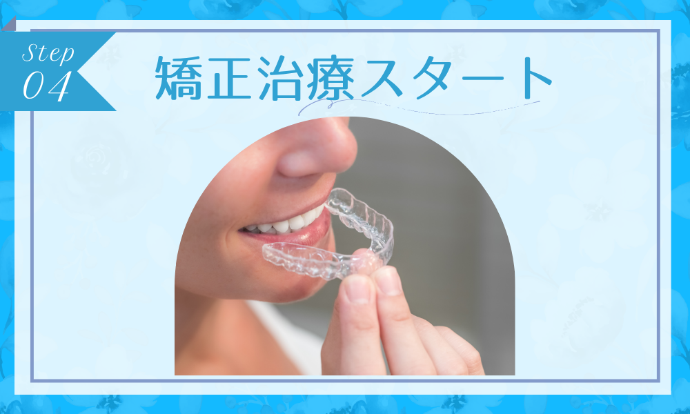 ステップ4：矯正治療スタート