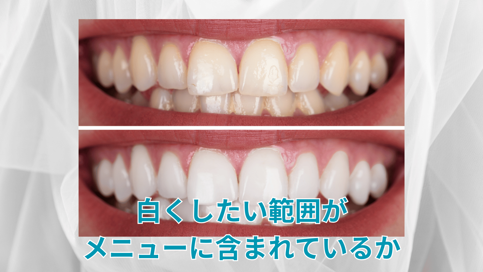 ポイント1