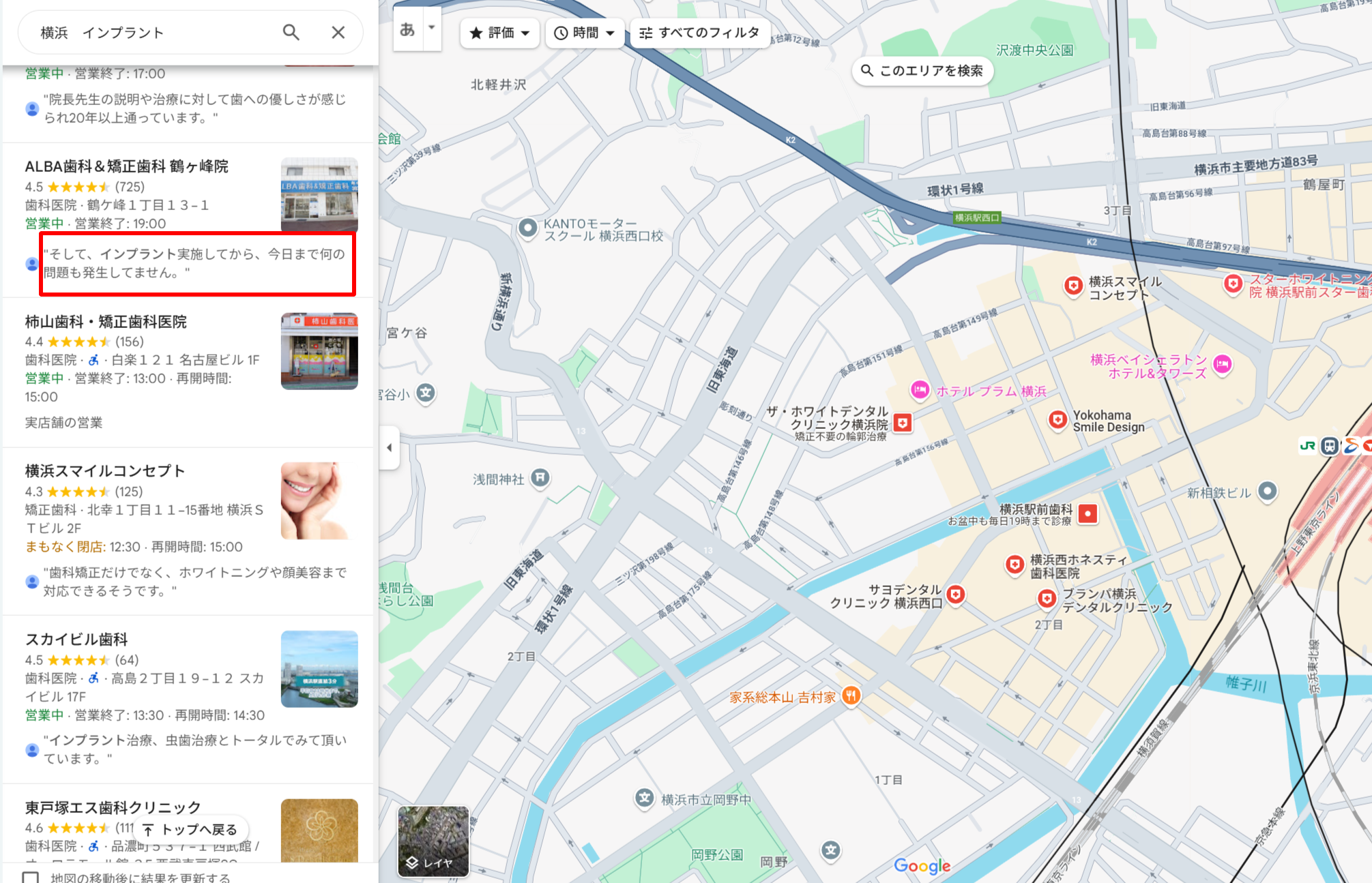 神奈川県横浜エリアにあるインプラント治療ができる歯科医院クリニックのGoogle口コミ評価
