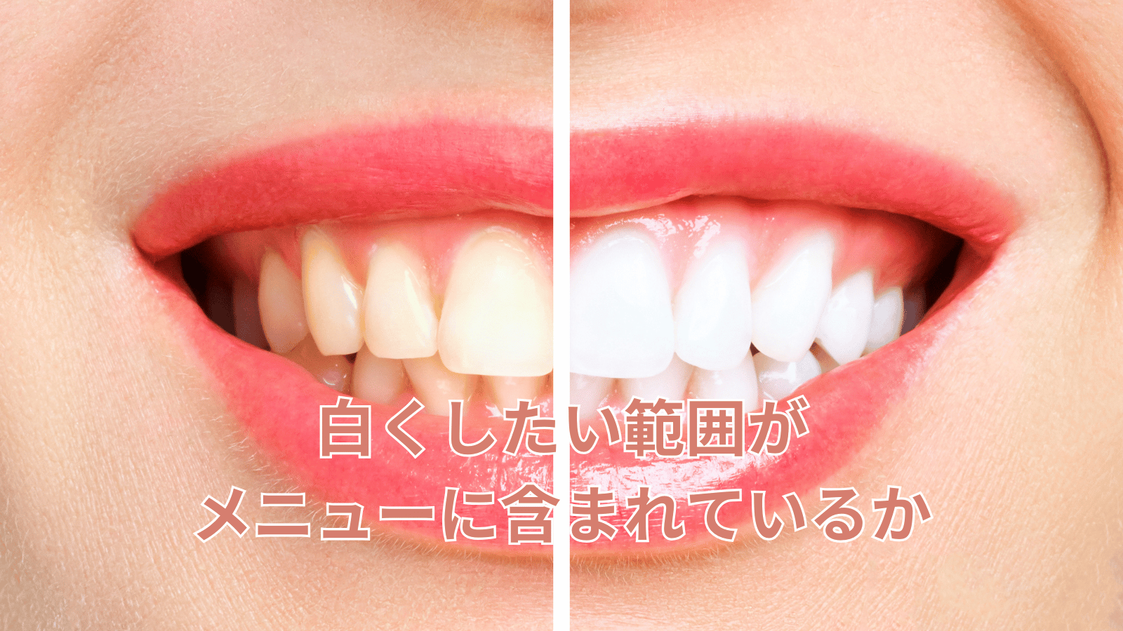ポイント2