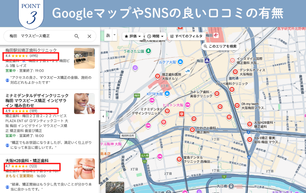 インビザラインポイント3