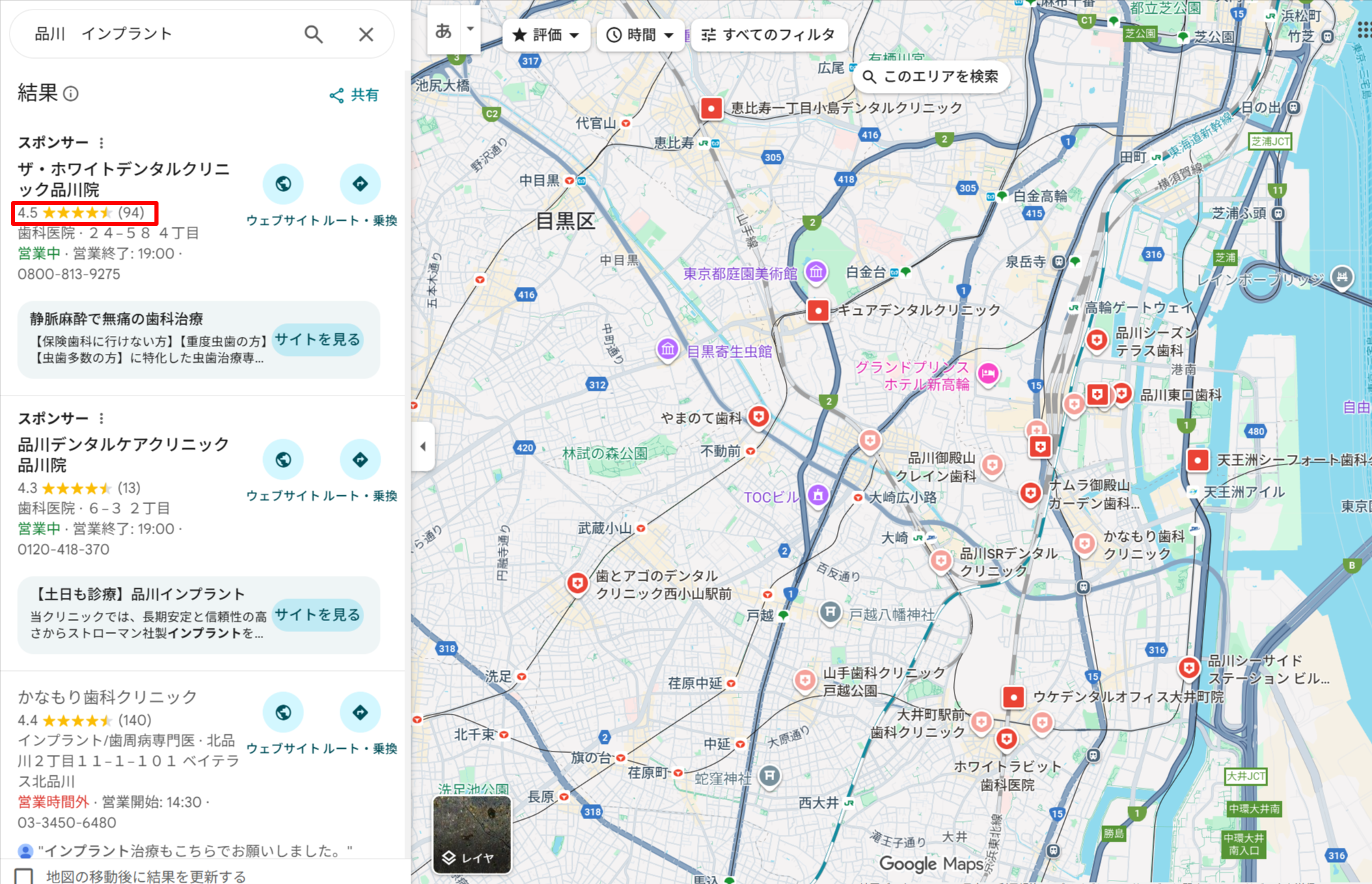 品川エリアでインプラント治療ができるクリニックのGoogle口コミ