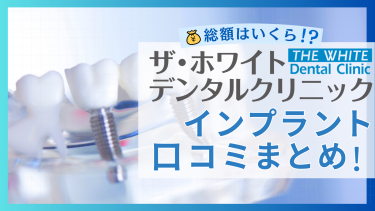 ザ・ホワイトデンタルクリニックのインプラントの口コミまとめ！総額はいくら？