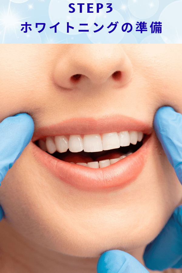 ステップ3:ホワイトニングの準備