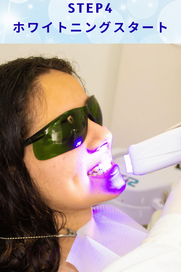 ステップ4:ホワイトニングスタート