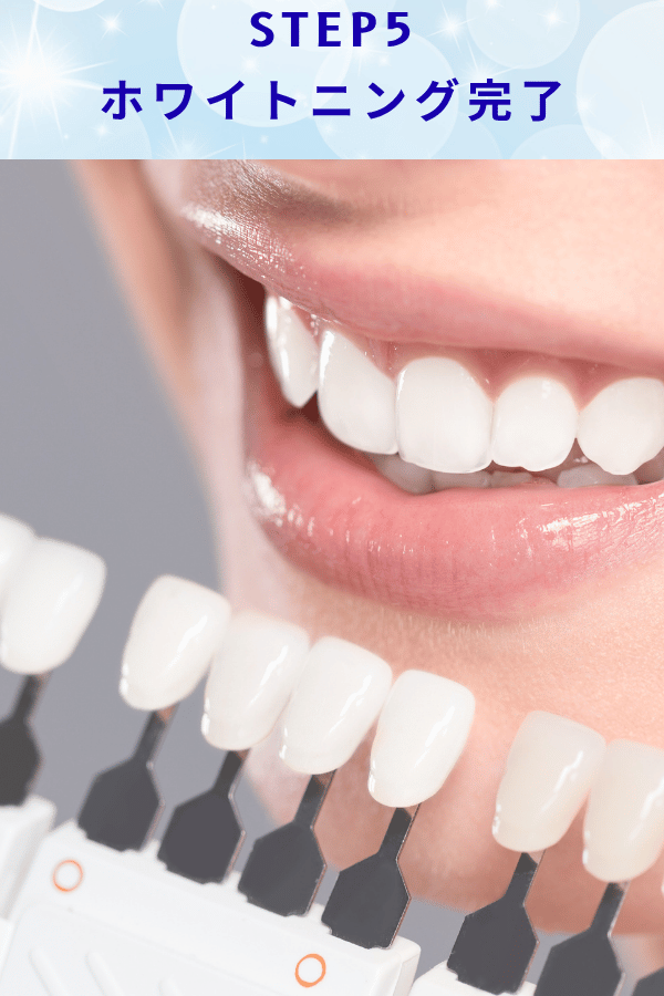 ステップ5:ホワイトニング完了