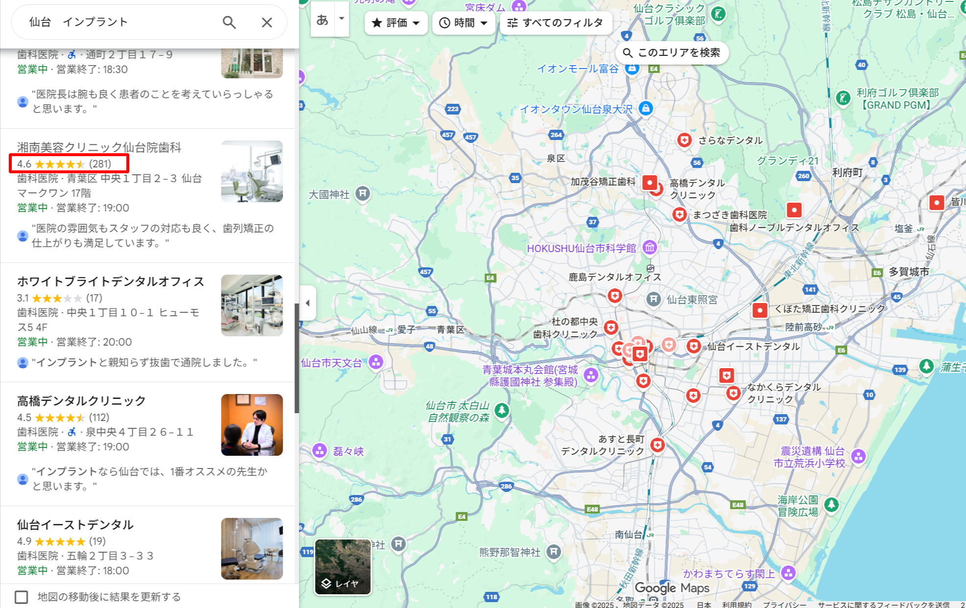 仙台エリアでインプラント治療ができるクリニックのGoogle口コミ評価