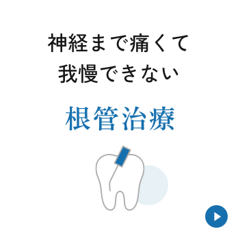神経まで痛くて我慢できない【根管治療】