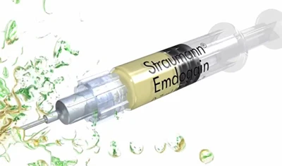 歯周病で溶けた骨を再生させる「エムドゲイン」