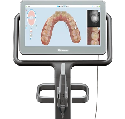 アイテロの画像