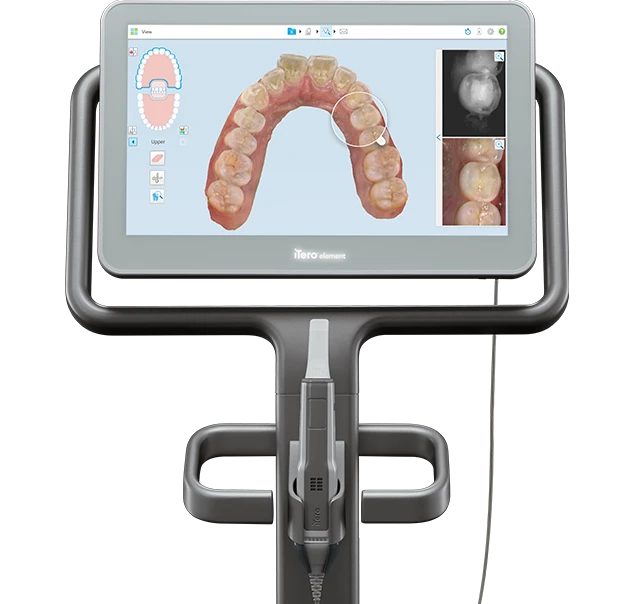 アイテロの画像